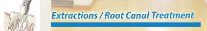 Extractions & Root Canal Treatment